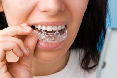 Wybielanie zębów – czym wybielić zęby?